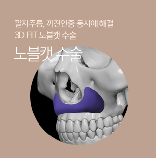 노블캣수술