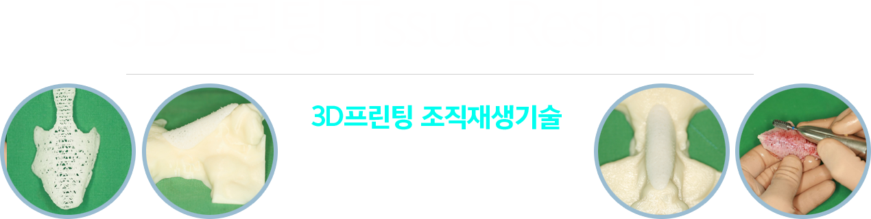 수술정보